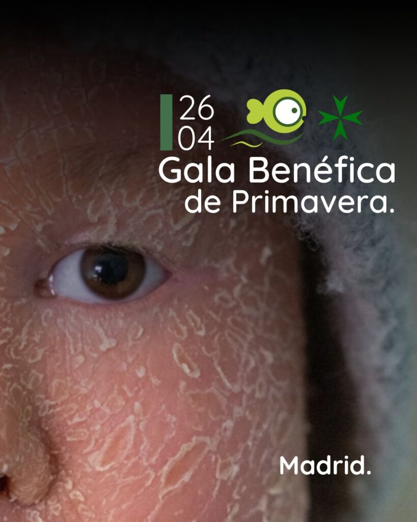 Gala benéfica a favor de la ictiosis